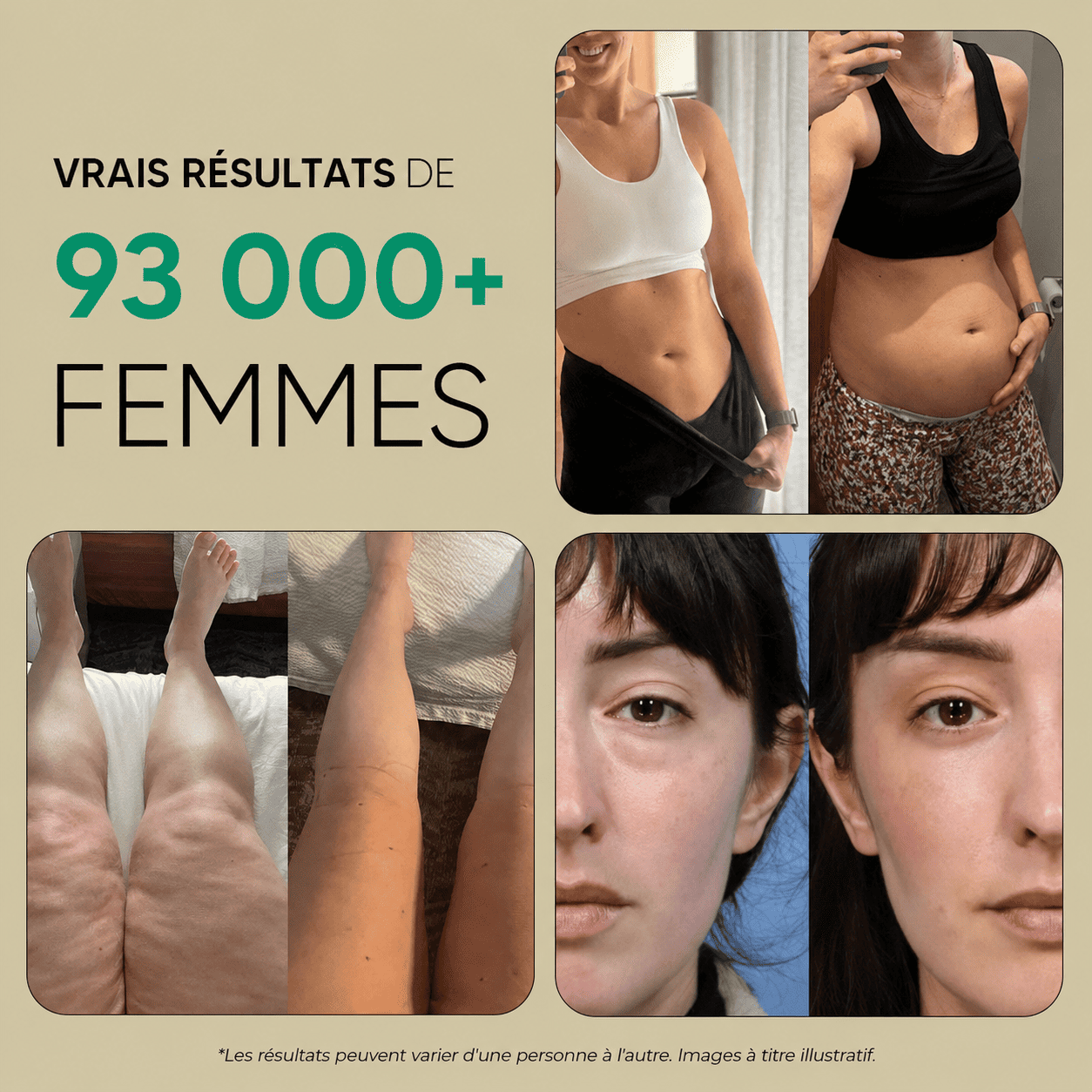 Nervia™ — Gélules de Drainage Lymphatique · Transformation totale en 60 jours